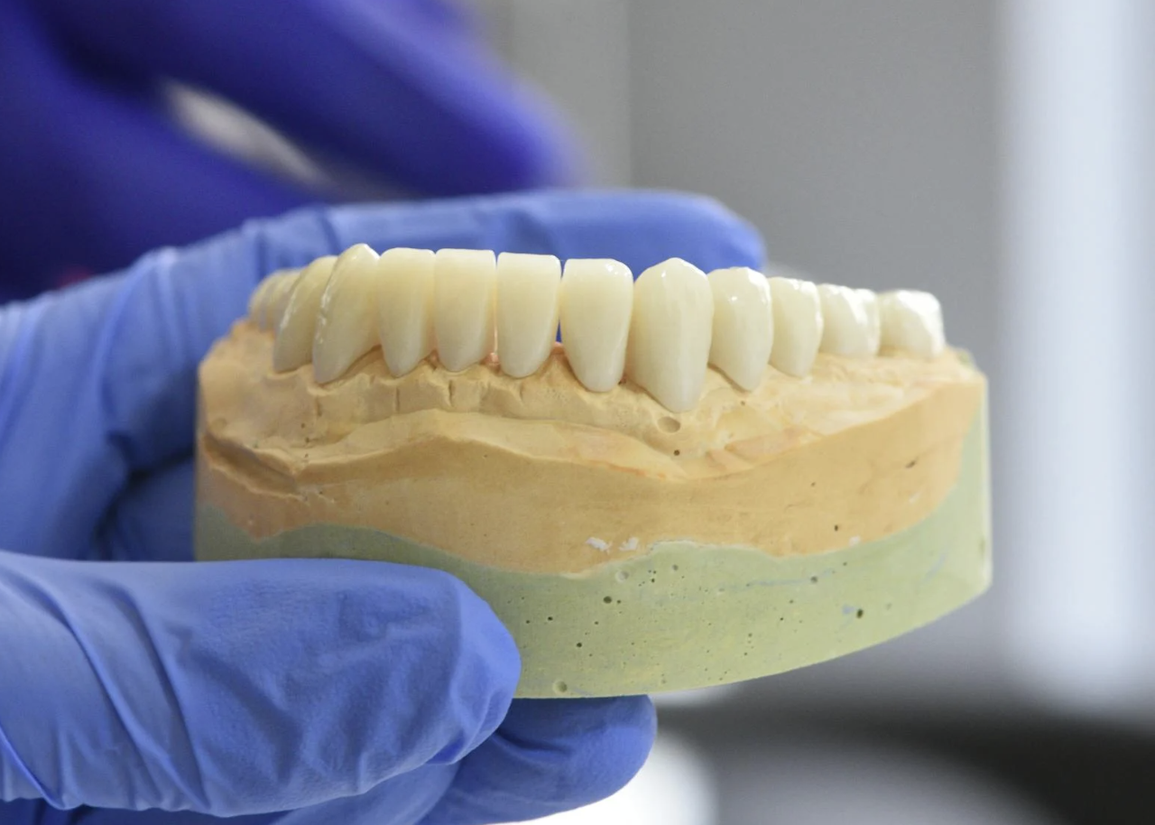 Dental Implants in Prattsville, NY, 12468